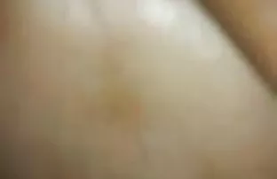 वीडियो चूसा और कूद  गर्भवती न होने के तरीके